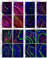 PAX2 Antibody in Immunocytochemistry (ICC/IF)