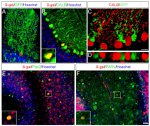 PAX2 Antibody in Immunocytochemistry (ICC/IF)