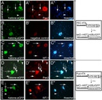 PAX2 Antibody in Immunocytochemistry (ICC/IF)