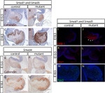 PAX2 Antibody in Immunohistochemistry (IHC)