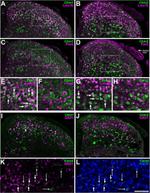 PAX2 Antibody in Immunohistochemistry (IHC)