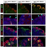 PAX2 Antibody in Immunohistochemistry (IHC)