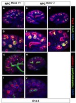 PAX2 Antibody in Immunohistochemistry (IHC)