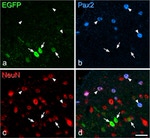 PAX2 Antibody in Immunohistochemistry (IHC)