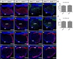 PAX2 Antibody in Immunohistochemistry (IHC)