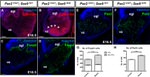 PAX2 Antibody in Immunohistochemistry (IHC)