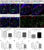 PAX2 Antibody in Immunohistochemistry (IHC)