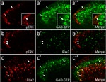 PAX2 Antibody in Immunohistochemistry (IHC)