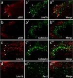 PAX2 Antibody in Immunohistochemistry (IHC)
