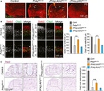 PAX2 Antibody in Immunohistochemistry (IHC)