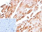 Tropomyosin, alpha-1 chain (striated muscle) Antibody in Immunohistochemistry (Paraffin) (IHC (P))