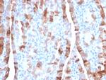 TPO (Thyroid Peroxidase) Monoclonal Antibody (TPO, 3701)