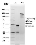 TPO (Thyroid Peroxidase) Antibody in SDS-PAGE (SDS-PAGE)