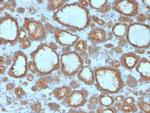 TPO (Thyroid Peroxidase) (Thyroid Marker) Antibody in Immunohistochemistry (Paraffin) (IHC (P))