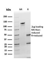 TPO (Thyroid Peroxidase) (Thyroid Marker) Antibody in SDS-PAGE (SDS-PAGE)