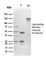 TPO (Thyroid Peroxidase) (Thyroid Marker) Antibody in SDS-PAGE (SDS-PAGE)