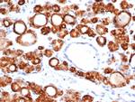 TPO (Thyroid Peroxidase) (Thyroid Marker) Antibody in Immunohistochemistry (Paraffin) (IHC (P))