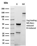 TPO (Thyroid Peroxidase) (Thyroid Marker) Antibody in SDS-PAGE (SDS-PAGE)