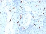 Tryptase Monoclonal Antibody (TPSAB1, 1961)