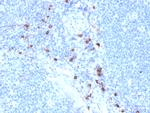 Tryptase (Mast Cell Marker) Monoclonal Antibody (TPSAB1/1963)