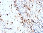 Tryptase (Mast Cell Marker) Recombinant Mouse Monoclonal Antibody (rTPSAB1/1963)