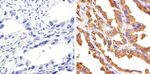 c-Met Polyclonal Antibody