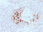 TRAF1 (TNFR-Associated Factor 1) (Lymphomatoid Papulosis Marker) Monoclonal Antibody (TRAF1/3298)