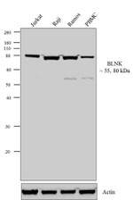 BLNK Antibody in Western Blot (WB)
