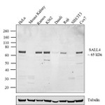 SALL4 Antibody in Western Blot (WB)