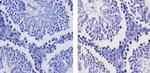 SALL4 Antibody in Immunohistochemistry (Paraffin) (IHC (P))