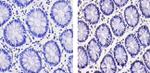 GLIS1 Antibody in Immunohistochemistry (Paraffin) (IHC (P))