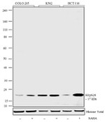 Phospho-Histone H3 (Ser28) Antibody in Western Blot (WB)