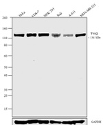 TYK2 Antibody in Western Blot (WB)