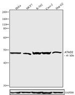 ATAD2 Antibody in Western Blot (WB)