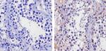 TIP60 Polyclonal Antibody