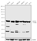 GLUT2 Polyclonal Antibody