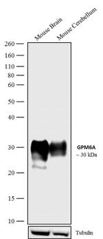 GPM6A Antibody in Western Blot (WB)