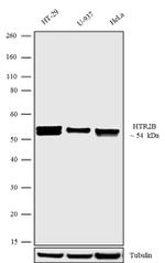 HTR2B Antibody in Western Blot (WB)