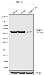 GPR56 Antibody in Western Blot (WB)