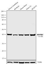 BDKRB2 Antibody in Western Blot (WB)