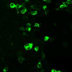 MCHR1 Polyclonal Antibody