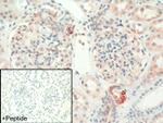 MCHR1 Antibody in Immunohistochemistry (IHC)