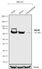 MC4R Antibody in Western Blot (WB)
