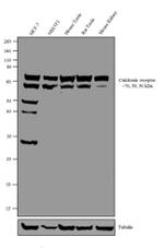 Calcitonin Receptor Antibody in Western Blot (WB)