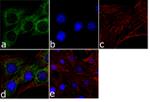 TPM3 Polyclonal Antibody