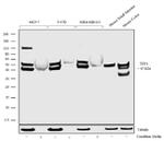 TFF3 Antibody in Western Blot (WB)