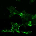 Calcitonin Receptor Polyclonal Antibody