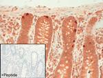 Calcitonin Receptor Antibody in Immunohistochemistry (IHC)
