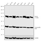 DTX3L Antibody in Western Blot (WB)