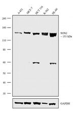 SOS2 Antibody in Western Blot (WB)